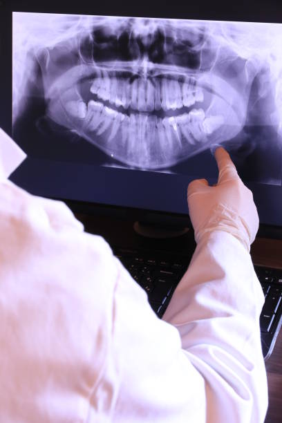 Best Dentist for Tooth Abscess  in Bayside Gardens, OR